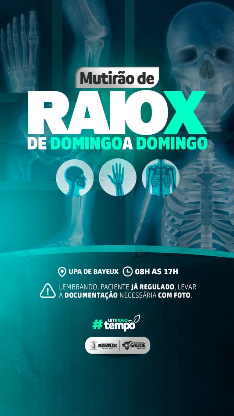*Prefeitura promove mutirão de RAIO-X de Domingo A Domingo na UPA de Bayeux
