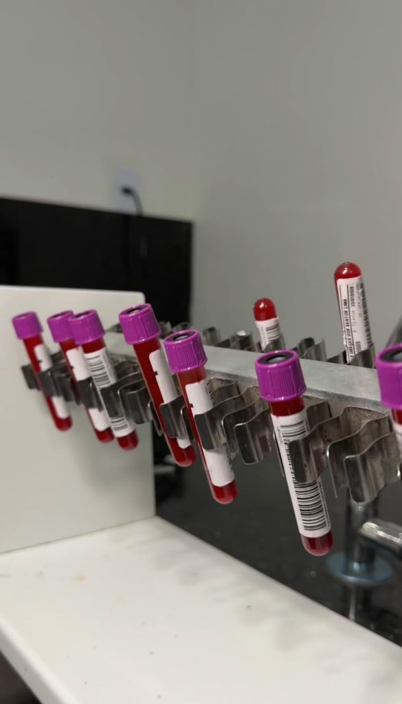 Laboratório Municipal de Bayeux passa a ofertar mais de 100 tipos de exames gratuitos